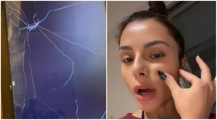 Aτύχημα σοκ για την Ελευθερία Ελευθερίου: Έπεσε στο κεφάλι της μία τηλεόραση [βίντεο]