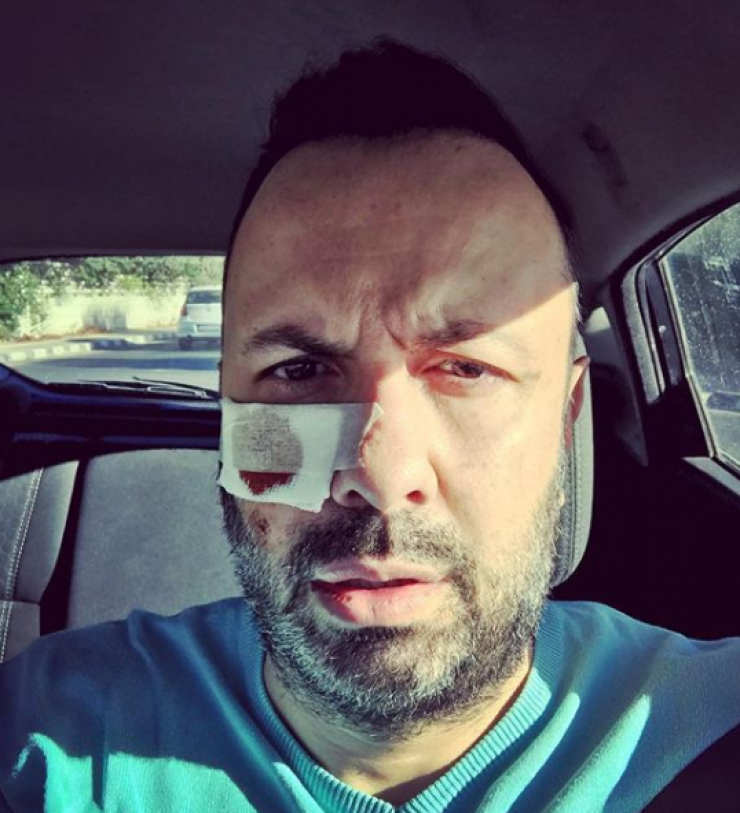 Μάθαμε τι συνέβη στον Τάσο Τρύφωνος!