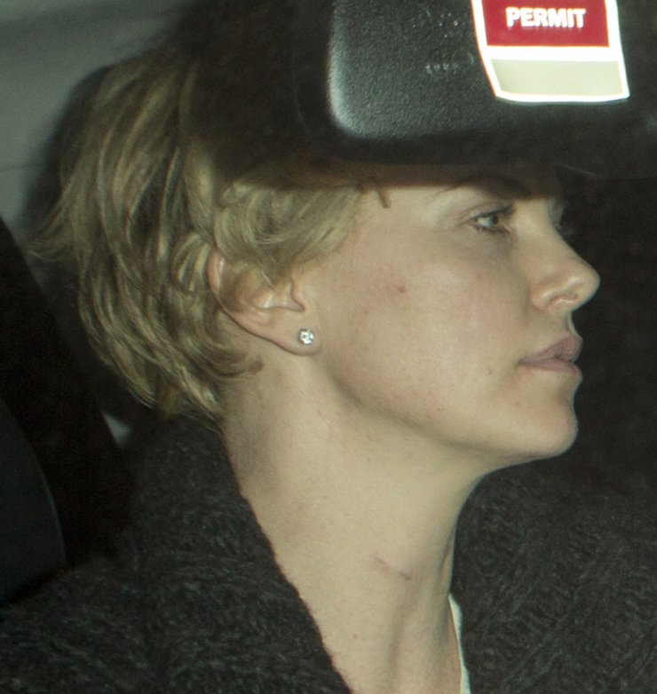 Charlize Theron: Το σημάδι στο λαιμό!!!