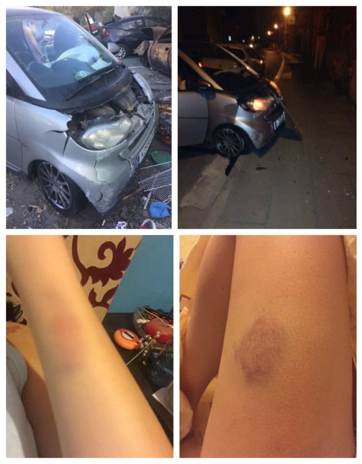 Το τρομακτικό ατύχημα για επώνυμη Κύπρια στη Λευκωσία και τα τραύματα σε όλο της το σώμα!