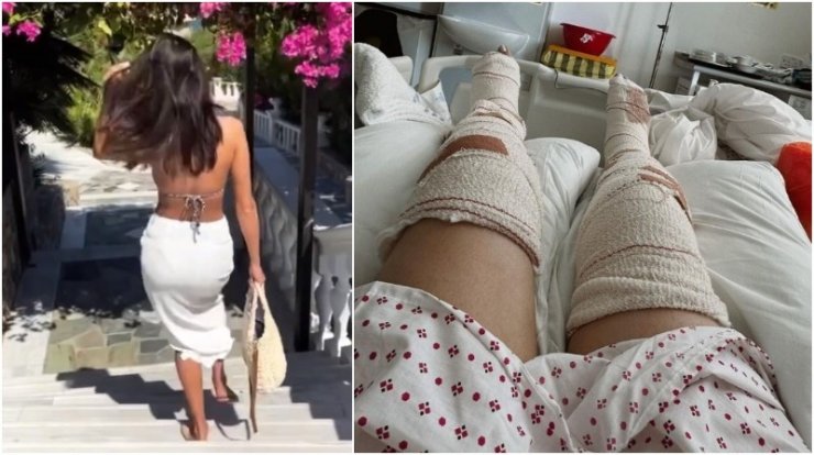 Συγκλονιστικές εικόνες Κύπριας tv personas: 35 εβδομάδων έγκυος με σπασμένα πόδια - Νεκρή η μητέρα της