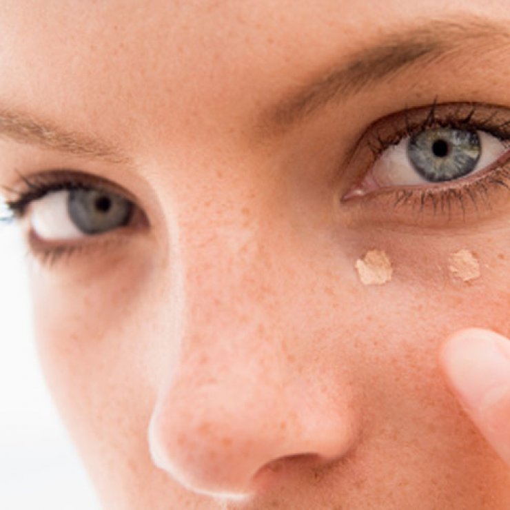 Μαύροι κύκλοι; Νέα θεραπεία υπόσχεται βλέμμα φωτεινό και ξεκούραστο!