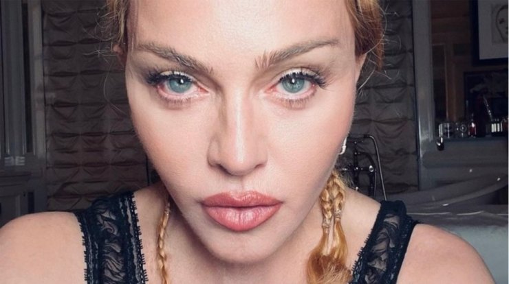 Madonna: Η επανεμφάνισή της στο instagram μετά την περιπέτεια υγείας της