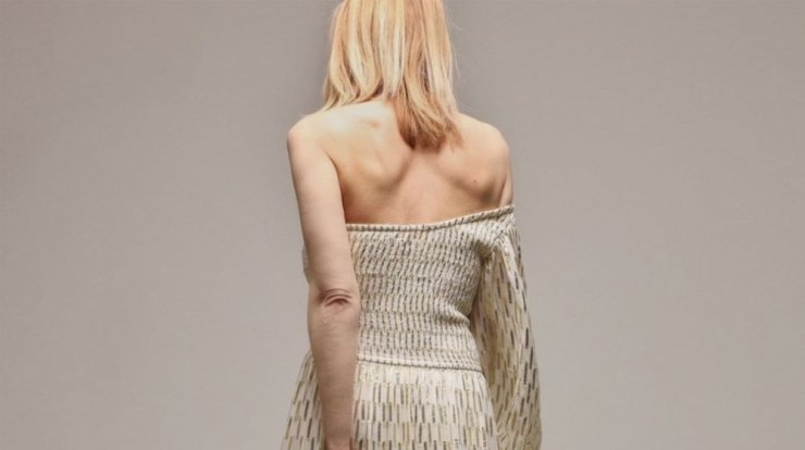 Γνωστή Ελληνίδα: "Αν πατήσεις αυτήν την στιγμή στην Google το όνομά μου θα σου βγει νευρική ανορεξία" [βίντεο]