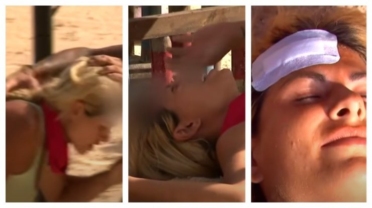 "Survivor": Ο τραυματισμός της Ευριδίκης Παπαδοπούλου στο κεφάλι [βίντεο] 