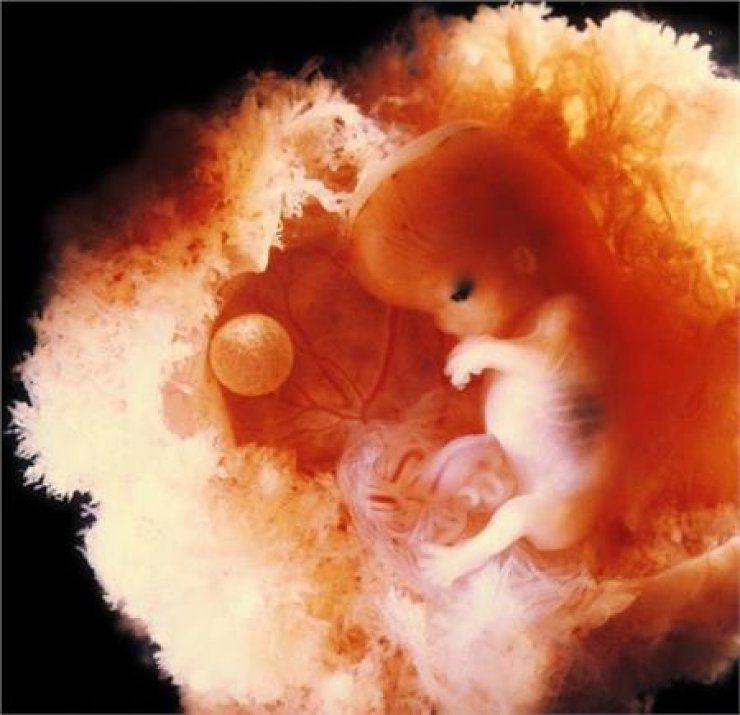 Απίθανες φωτογραφίες: Το θαύμα της ζωής μέσα από τον φακό του Lennart Nilsson 