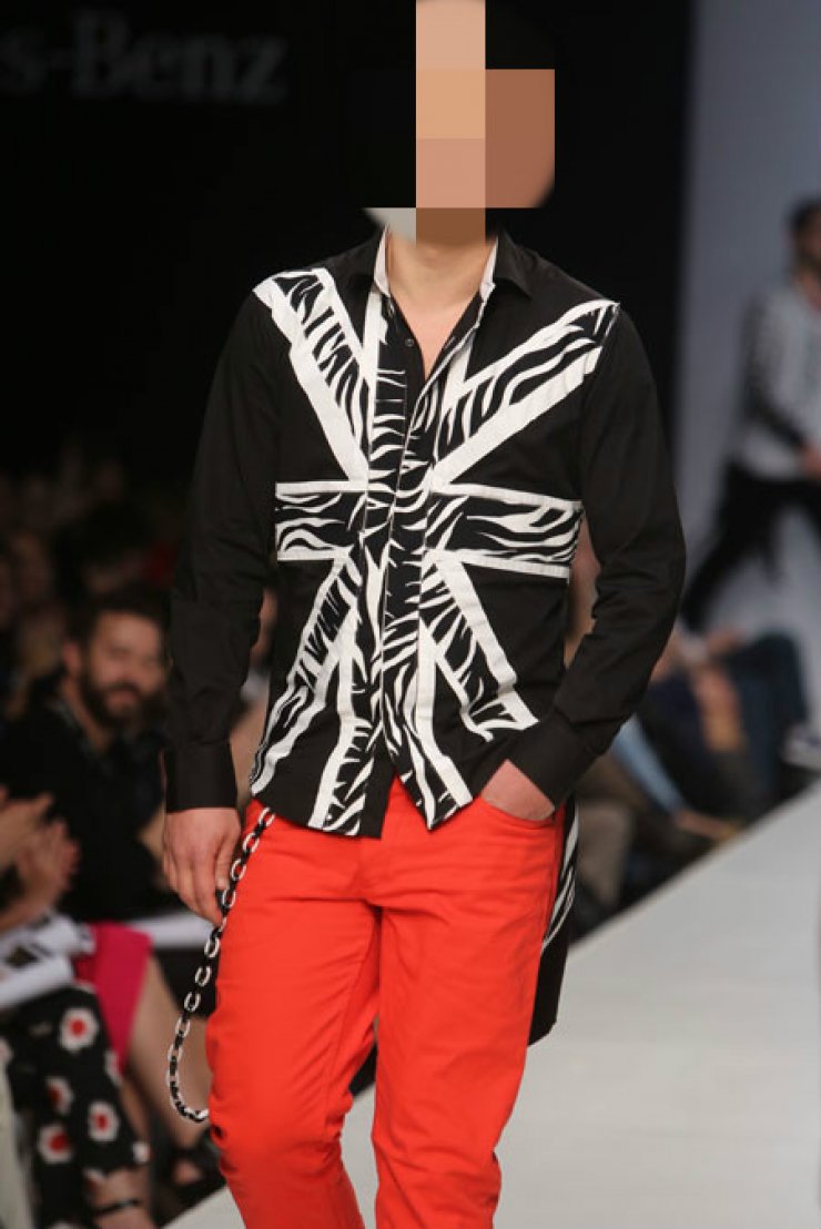 Έλληνας τραγουδιστής αποκαλύπτει: “Πάσχω από αλωπεκία. Στα 11 μου έχασα όλα τα μαλλιά μου”