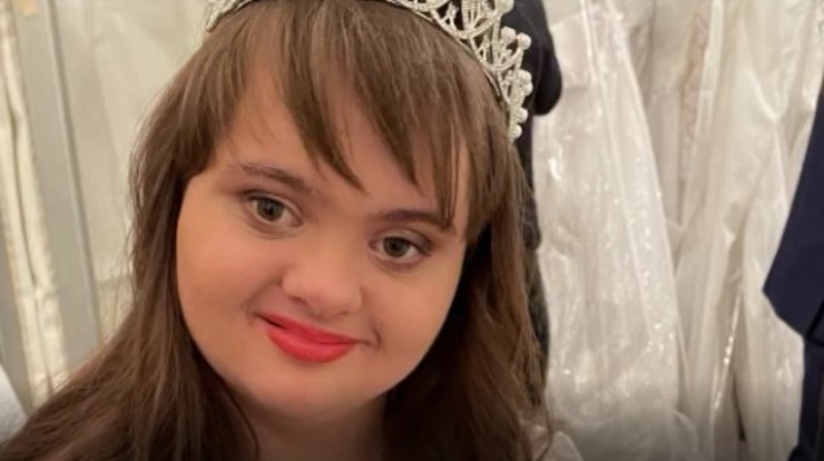 Η 18χρονη Βαλάντω είναι η πρώτη στην Κύπρο με σύνδρομο down που μπήκε στον χώρο του μόντελινγκ [βίντεο]