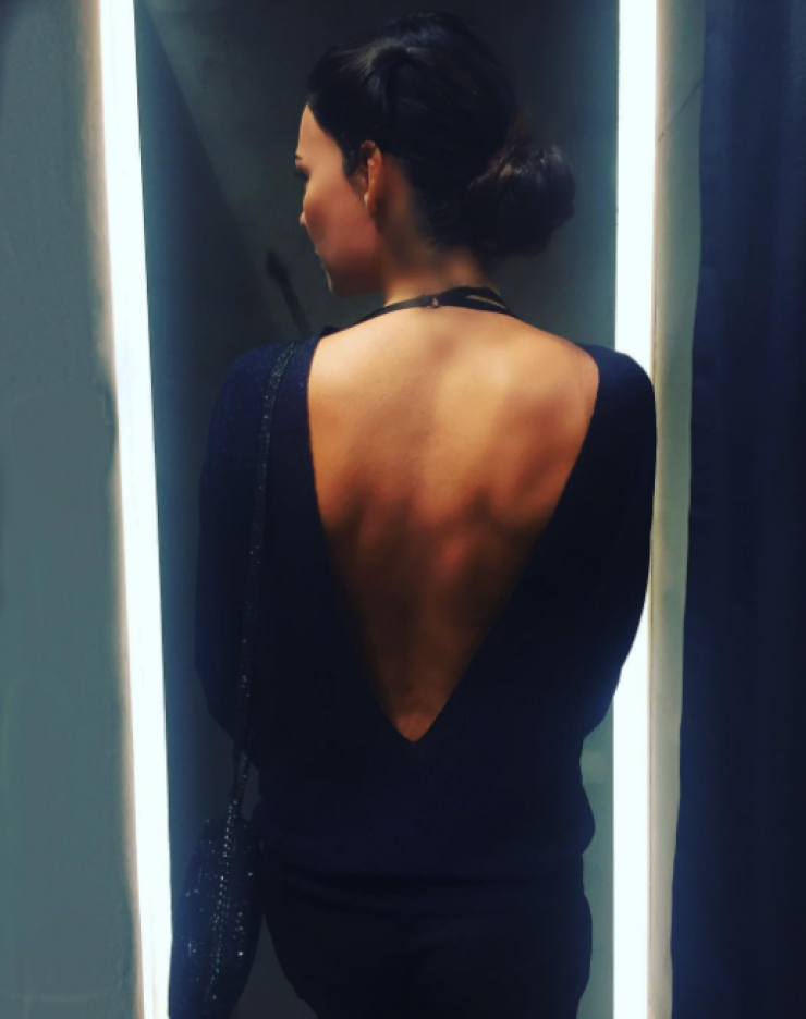 Ακομπλεξάριστη! Επώνυμη Ελληνίδα έκανε μπότοξ και το έδειξε στο instagram!