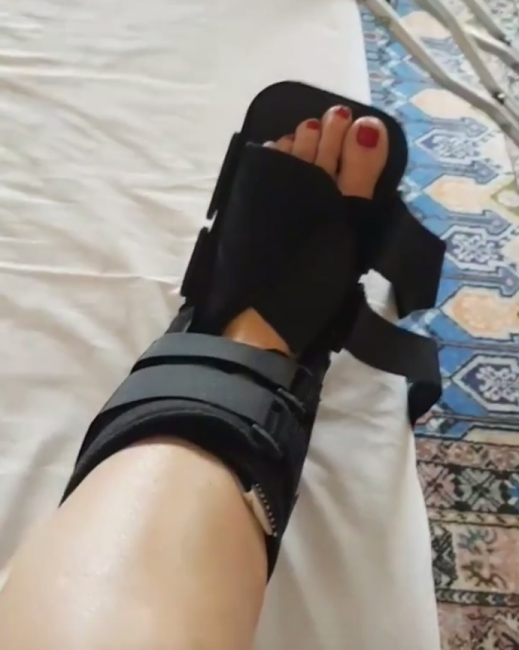 Το τραυματισμένο πόδι Ελληνίδας παρουσιάστριας! [βίντεο]