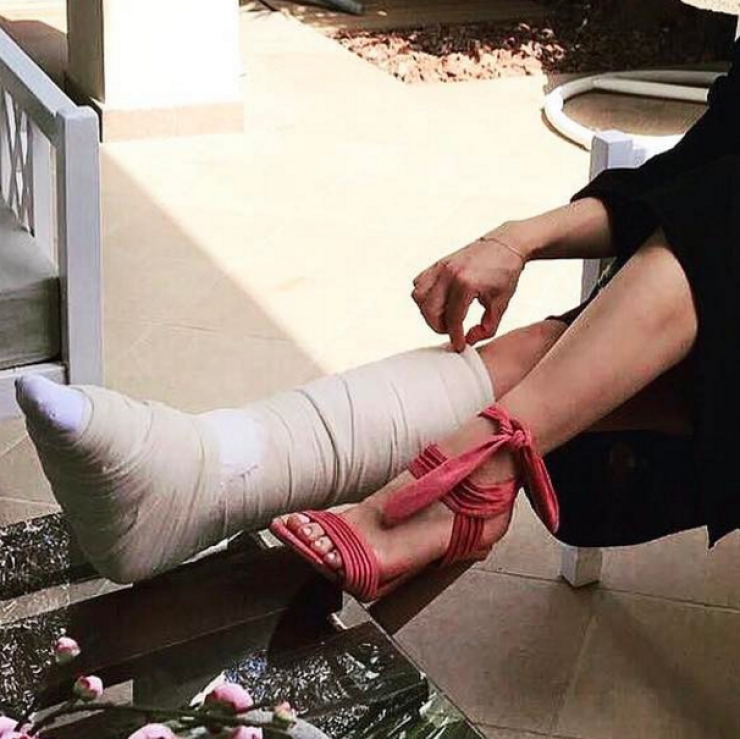 Στο γύψο το πόδι Κύπριας παρουσιάστριας! [εικόνες]