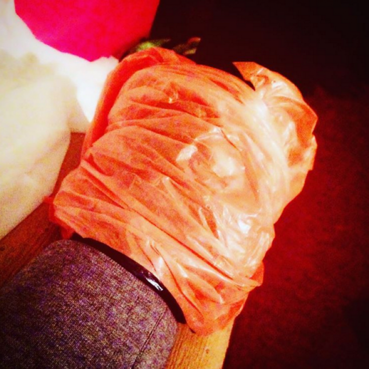 Το ατύχημα Ελληνίδας τραγουδίστριας επί σκηνής!