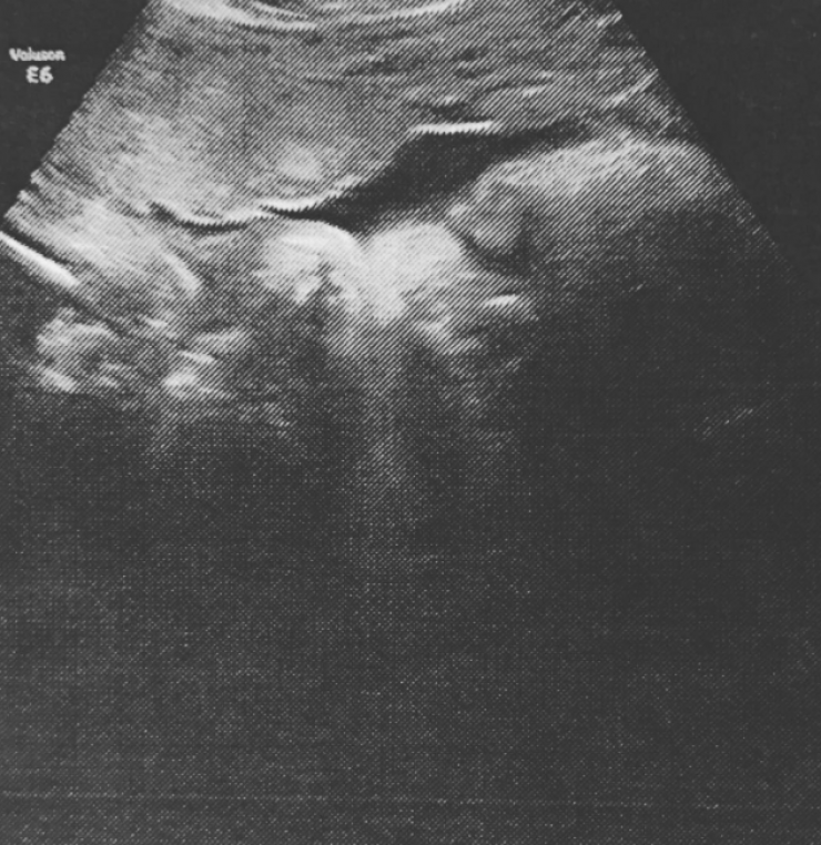 Πασίγνωστος ηθοποιός θα γίνει μπαμπάς για πρώτη φορά και μας δείχνει το υπερηχογράφημα!