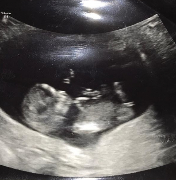 Γνωστός τραγουδιστής θα γίνει μπαμπάς για δεύτερη φορά!