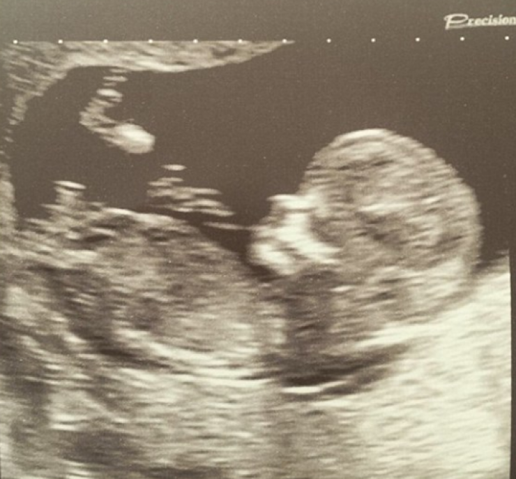 Πατέρας για τέταρτη φορά επώνυμος Κύπριος!