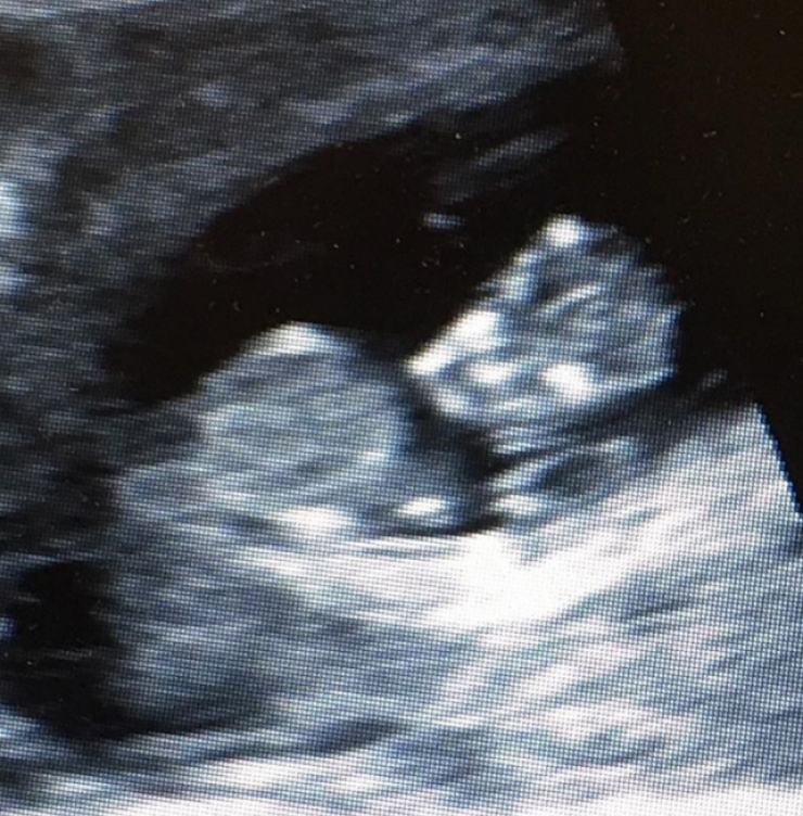 Ποιος επώνυμος θα γίνει μπαμπάς για δεύτερη φορά;