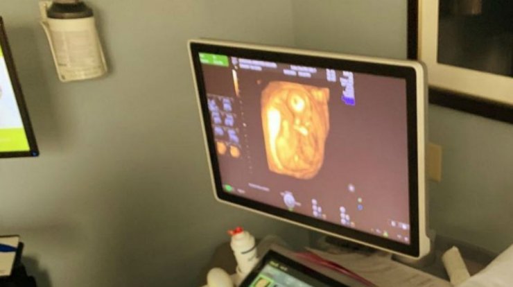 Ευχάριστα νέα στη showbiz! Γνωστό μοντέλο έγκυος για δεύτερη φορά!