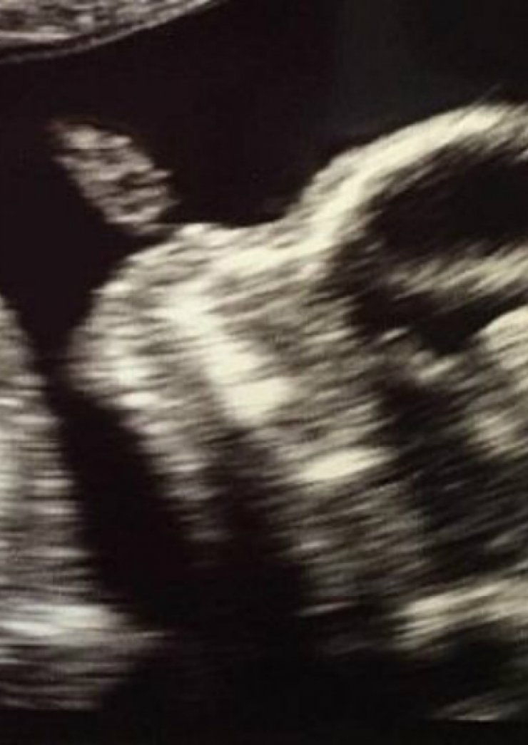 Ο πρώτος υπέρηχος του μωρού τους και το συγκινητικό μήνυμα στο instagram!